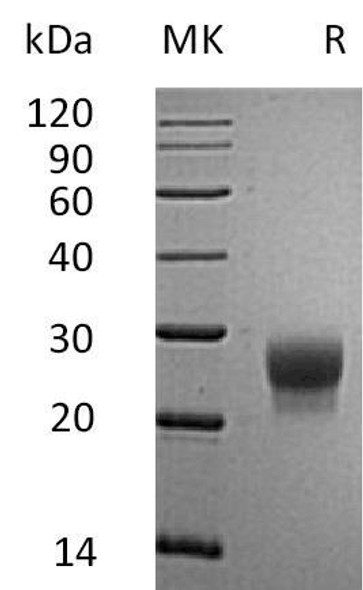 Mouse G-CSF/CSF3 Recombinant Protein (RPES0938)