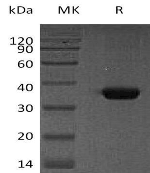 Human Osteonectin/SPARC Recombinant Protein (RPES0953)