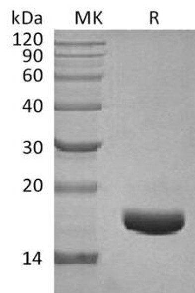 Human CTGF/CCN2 Recombinant Protein (RPES0988)