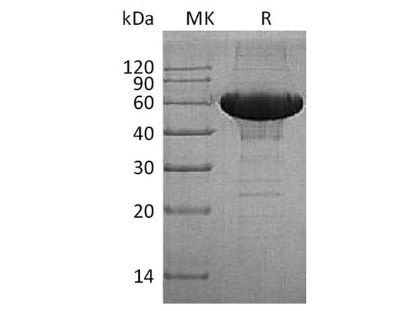 Human MMP-3 Recombinant Protein (RPES0996)