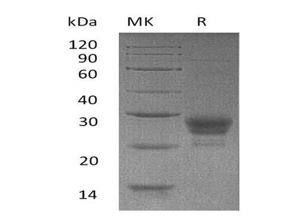 Human TNFSF4/OX40L Recombinant Protein (RPES1007)