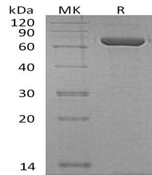 Human Copine/CPNE1 Recombinant Protein (RPES1021)