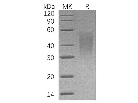 Human LFA-3/CD58 Recombinant Protein (RPES1028)