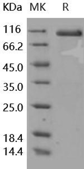 Human DLL4 Recombinant Protein (RPES1034)