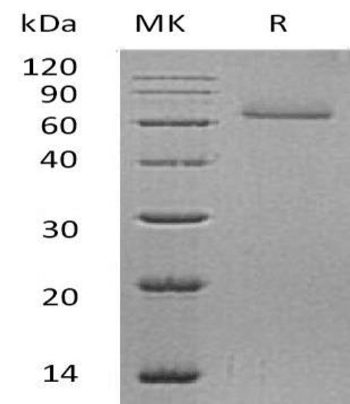 Human Corneodesmosin/CDSN Recombinant Protein (RPES1038)