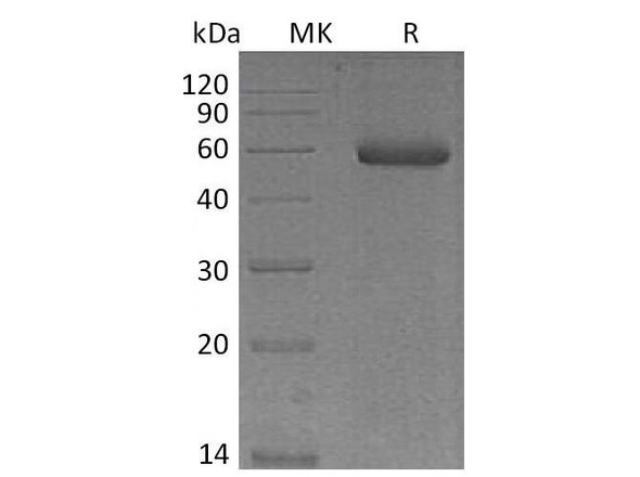 Mouse NGAL/Lipocalin-2 Recombinant Protein (RPES1047)