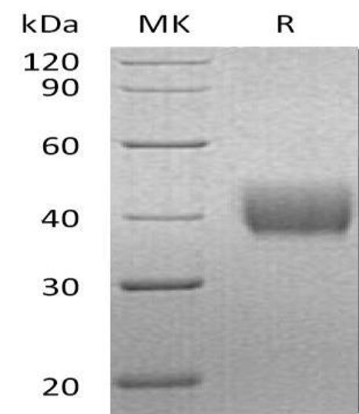 Human Mesothelin/MSLN Recombinant Protein (RPES1049)