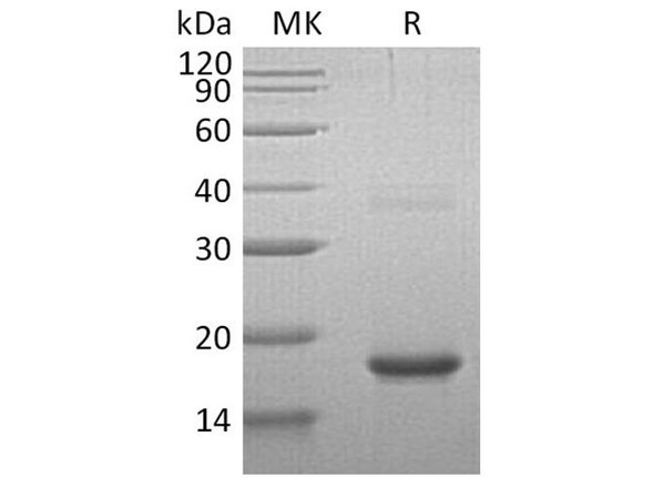 Human Cornulin/CRNN Recombinant Protein (RPES1056)