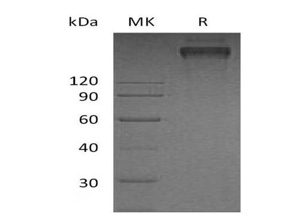 Human TRAIL R3/TNFRSF10C Recombinant Protein (RPES1059)