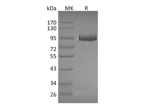 Mouse Myeloperoxidase/MPO Recombinant Protein (RPES1065)