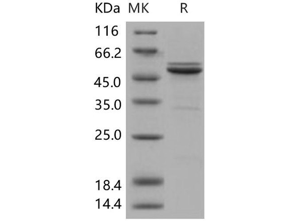 Human JNK2/MAPK9 Recombinant Protein (RPES1069)
