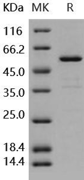Human CNDP2/CPGL/PEPA Recombinant Protein (RPES1070)