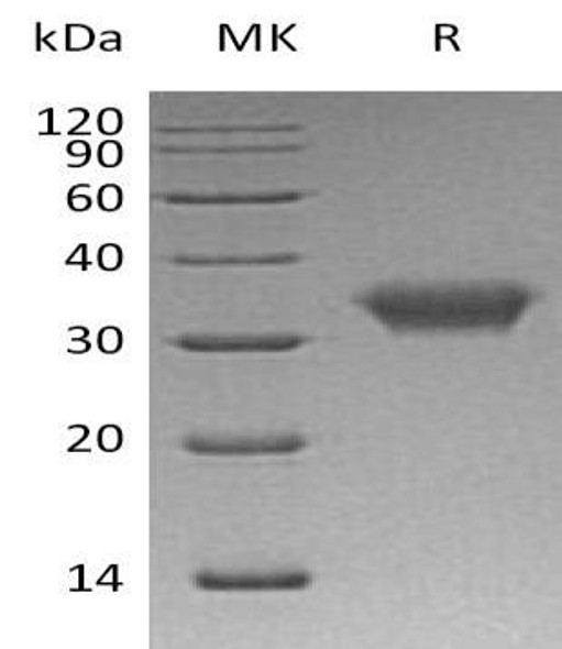 Human CXADR/CAR Recombinant Protein (RPES1112)