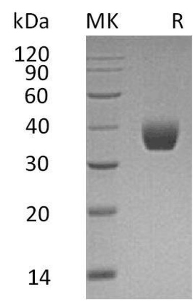 Human PPT1 Recombinant Protein (RPES1114)