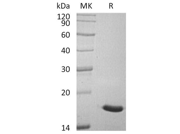 Human ACP1/LMW-PTP Recombinant Protein (RPES1121)