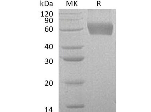 Human CSF2RA/GM-CSFR Recombinant Protein (RPES1140)