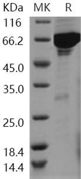 Human VRK1 Recombinant Protein (RPES1145)