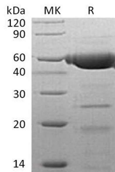 Human Galactolipase/PLRP2 Recombinant Protein (RPES1154)