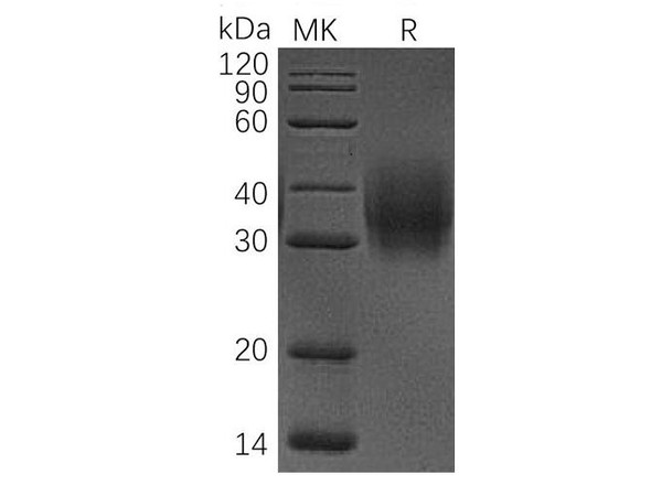Human CD47/IAP Recombinant Protein (RPES1160)