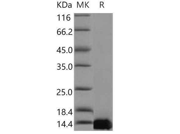 Human TFAP2C/AP2-GAMMA Recombinant Protein (RPES1163)