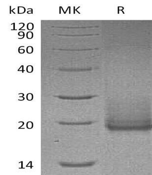 Human Cryptic/CFC1 Recombinant Protein (RPES1170)