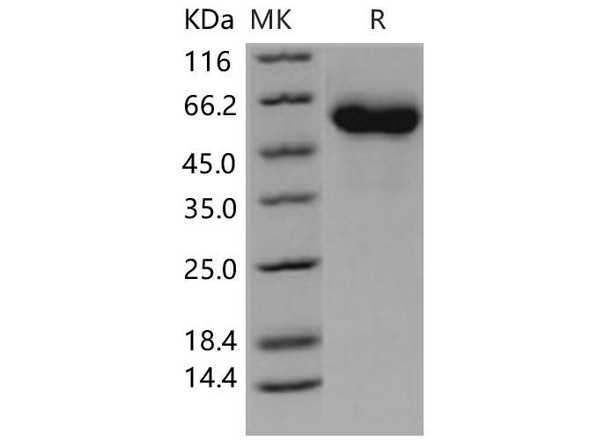 Complement Factor H/CFH Recombinant Protein (RPES1183)