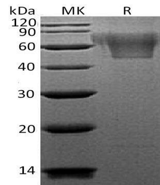 Human CX3CL1/Fractalkine Recombinant Protein (RPES1207)