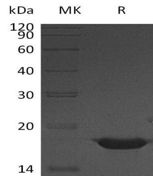 Human YY1 Recombinant Protein (RPES1210)