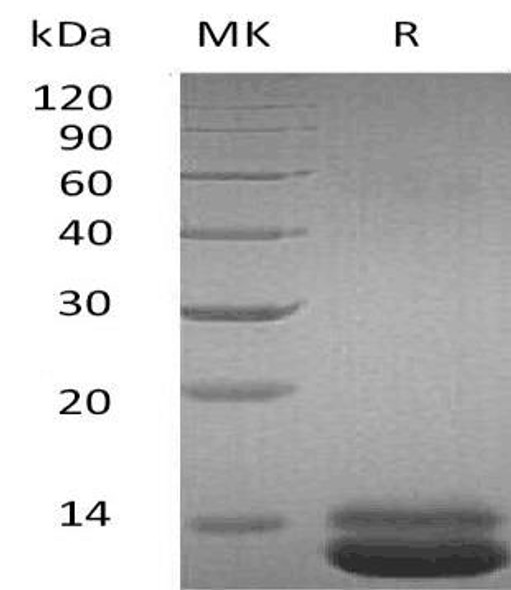 Human CXCL1 Recombinant Protein (RPES1222)