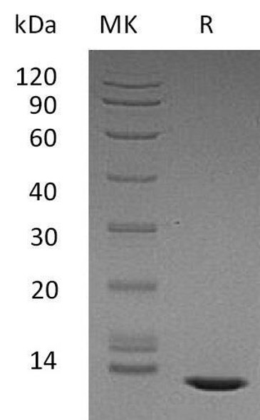 Human TGFB2 Recombinant Protein  (RPES1225)