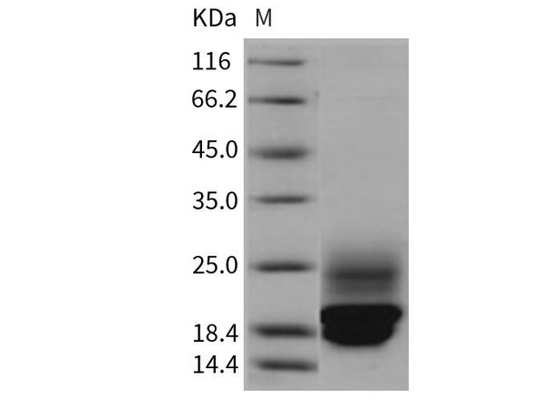 Rat Cystatin C/CST3 Recombinant Protein (RPES1235)