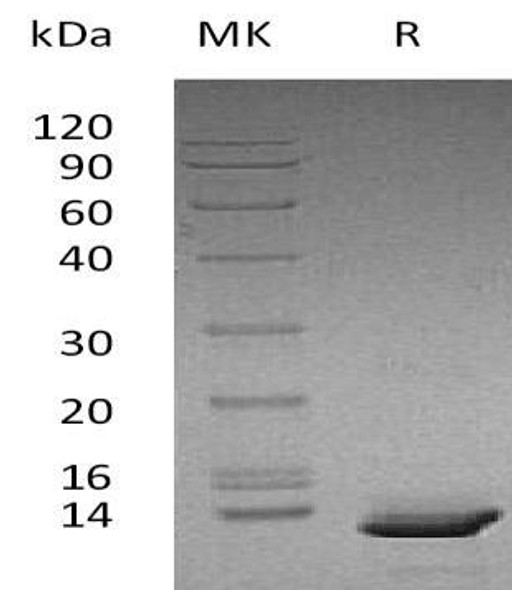 Human CXCL10 Recombinant Protein (RPES1239)