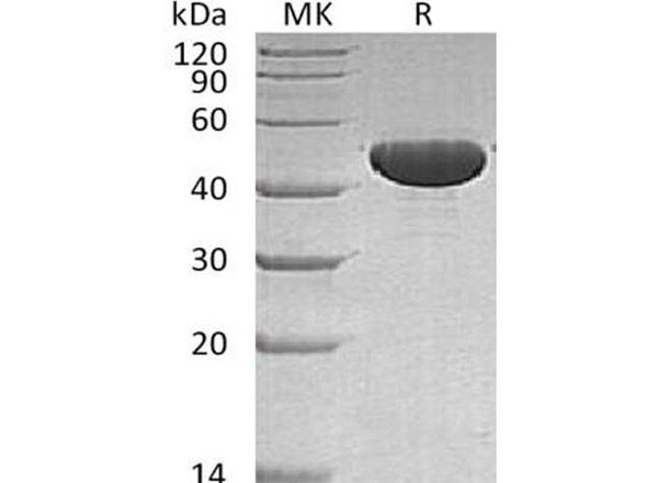 Human APOA4 Recombinant Protein (RPES1245)