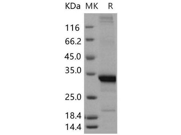 Beta-amyloid 42/Beta-APP42 Recombinant Protein (RPES1251)