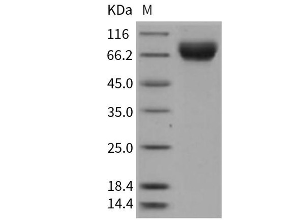 Rat E-Selectin/SELE Recombinant Protein (RPES1252)