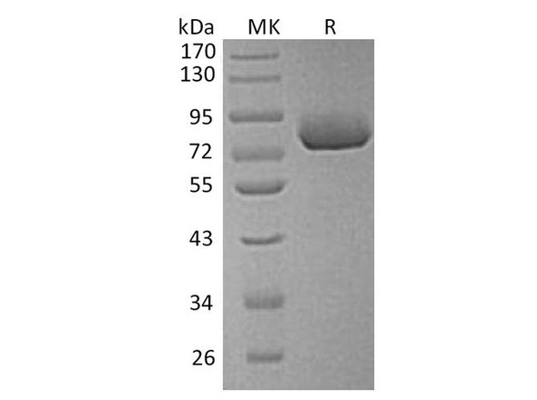 Human Osteopontin/SPP1 Recombinant Protein (RPES1255)