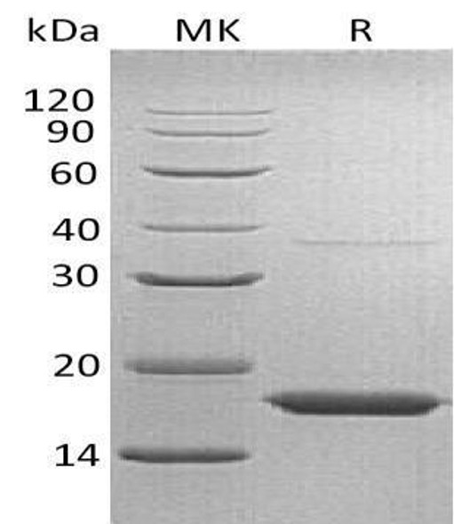Human Transthyretin/TTR Recombinant Protein (RPES1259)