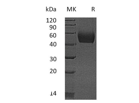 Mouse Lumican/LUM Recombinant Protein (RPES1266)