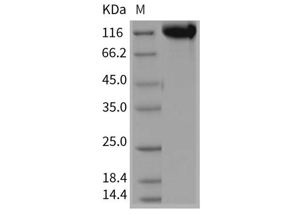 Rat E-Selectin/SELE Recombinant Protein (RPES1272)
