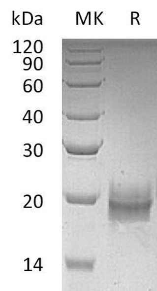 Human Trefoil Factor 2/TFF2 Recombinant Protein (RPES1278)