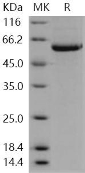 Human STK4/MST1 Recombinant Protein (RPES1285)
