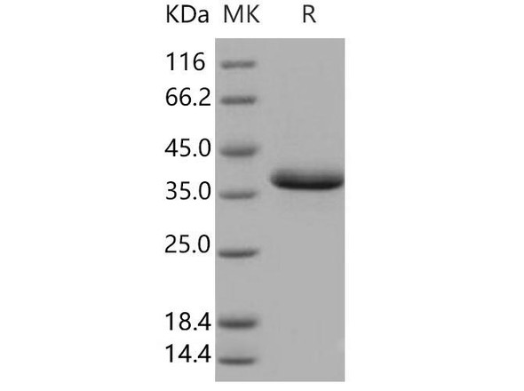 Human EGF Recombinant Protein (RPES1293)