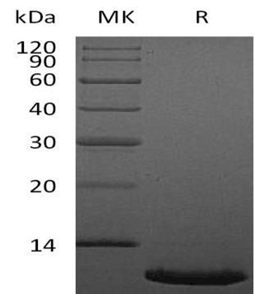 Human CXCL12/SDF Recombinant Protein (RPES1294)