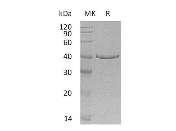 Human GMPR Recombinant Protein (RPES1301)