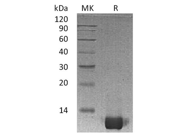 Human IL-8/CXCL8 Recombinant Protein (RPES1302)