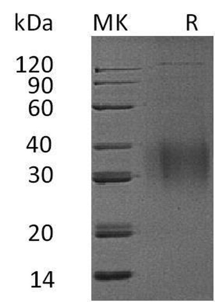 Mouse Interleukin-9/IL-9 Recombinant Protein (RPES1317)
