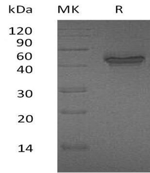 Human IL2 p40/IL2B Recombinant Protein (RPES1328)