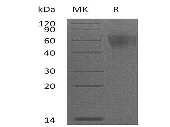 Mouse IL-2RG/CD132 Recombinant Protein (RPES1339)