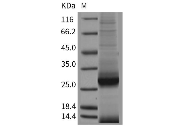 Mouse ApoAI Recombinant Protein (RPES1371)