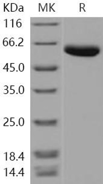 Carboxypeptidase B2/CPB2 Recombinant Protein (RPES1380)